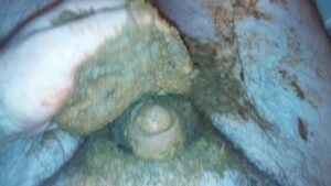 Free Scat Porn