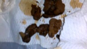 Free Scat Porn