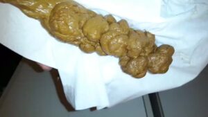 Free Scat Porn