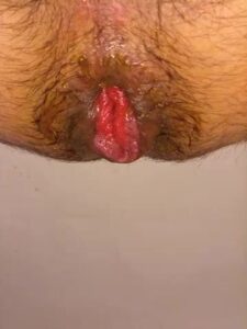 Free Scat Porn