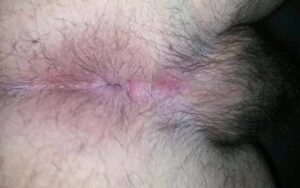 Free Scat Porn