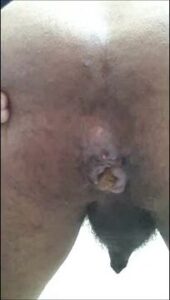 Free Scat Porn