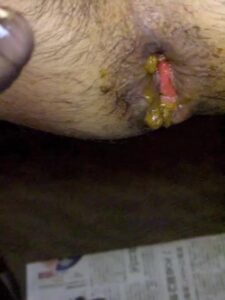Free Scat Porn