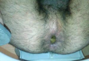 Free Scat Porn