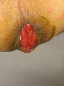 Free Scat Porn