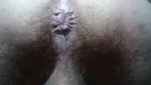 Free Scat Porn