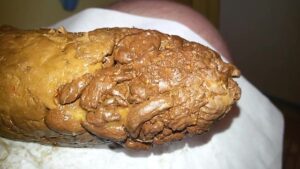 Free Scat Porn