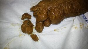 Free Scat Porn