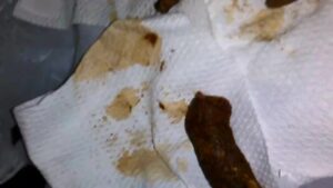 Free Scat Porn