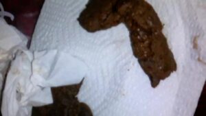 Free Scat Porn