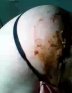 Free Scat Porn