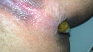 Free Scat Porn