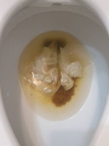 Free Scat Porn
