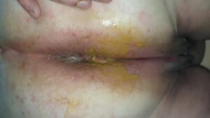 Free Scat Porn
