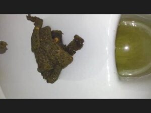 Free Scat Porn