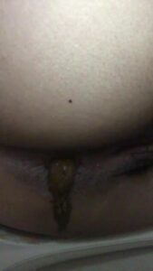 Free Scat Porn