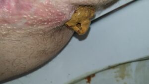 Free Scat Porn