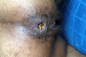 Free Scat Porn