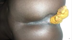 Free Scat Porn