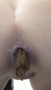 Free Scat Porn