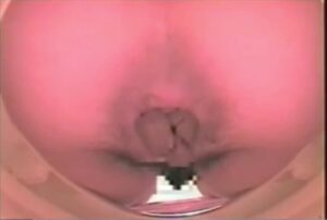 Free Scat Porn