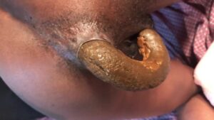Free Scat Porn