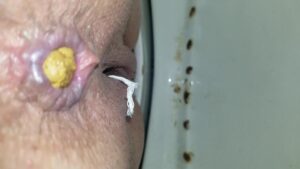 Free Scat Porn