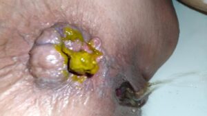 Free Scat Porn