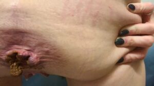 Free Scat Porn