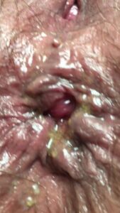 Free Scat Porn