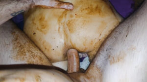 Free Scat Porn