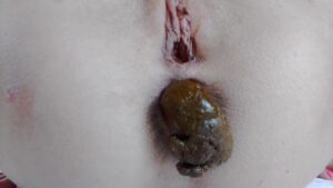 Free Scat Porn