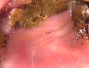 Free Scat Porn