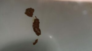 Free Scat Porn