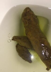 Free Scat Porn