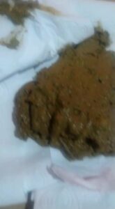 Free Scat Porn