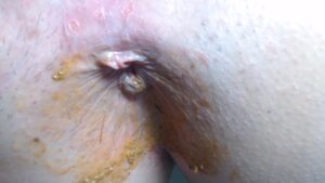 Free Scat Porn