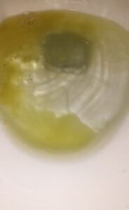 Free Scat Porn