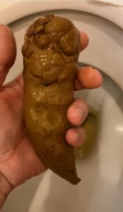 Free Scat Porn