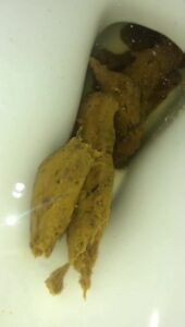 Free Scat Porn