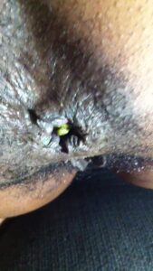 Free Scat Porn