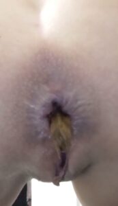 Free Scat Porn