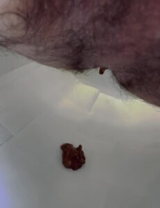 Free Scat Porn