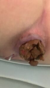 Free Scat Porn