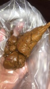 Free Scat Porn