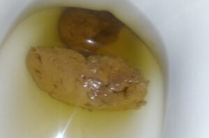 Free Scat Porn