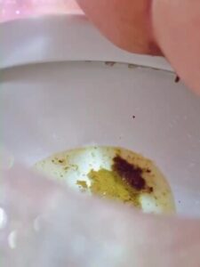 Free Scat Porn