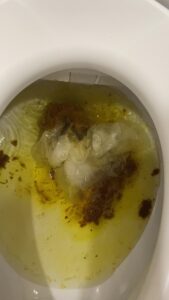 Free Scat Porn
