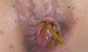 Free Scat Porn