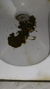 Free Scat Porn